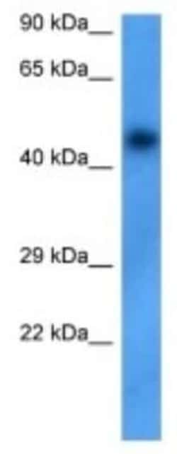 UGT Rabbit anti-Human, Polyclonal, Novus Biologicals:Antibodies:Primary